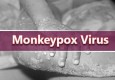 علوم پزشکی ایرانشهر برای دومین بار متوالی ورود آبله میمون در چابهار را تکذیب کرد
